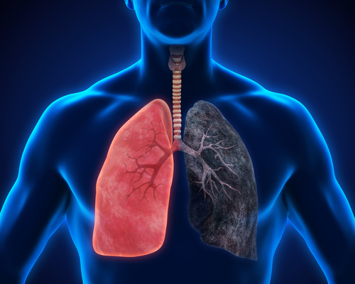 IPU-Chronic-obstructive-pulmonary-disease-course