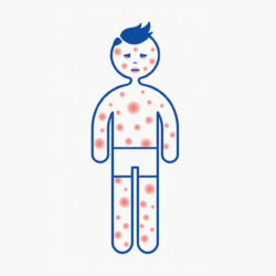 Anaphylaxis Identification and Management for Healthcare Workers Course
